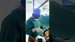 Varicose Veins Treatment maahospitals maaent EndovenousLaserTreatment shorts youtubeshorts [upl. by Asiela]