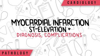 STsegment Elevation Myocardial Infarction Heart Attack  Diagnosis amp Symptoms Complication [upl. by Akcinehs22]