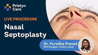 Deviated Septum Surgery  Endoscopic Septoplasty Explained  Pristyn Care [upl. by Elpmet]