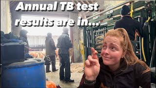 Annual TB Test time [upl. by Tsan]