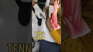 Tennis Elbow Steroid Injection  ortho elbow tenniselbow steroid injection [upl. by Aldos]