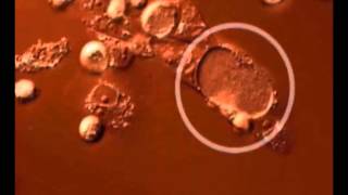 Time lapse video of the Chlamydia trachomatis developmental cycle [upl. by Cybill]