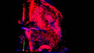 3D reconstruction Twophoton microscopy of DsRed mouse lymph node [upl. by Madelon]