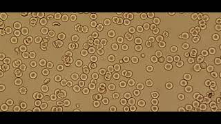 Compatible Crossmatching under a microscope [upl. by Nahtonoj]