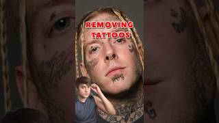 Tom MacDonald Makeover  Removing Tattoos tommacdonald rap [upl. by Rovaert]