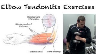 Golfers Elbow Exercises for elbow pain [upl. by Xer]