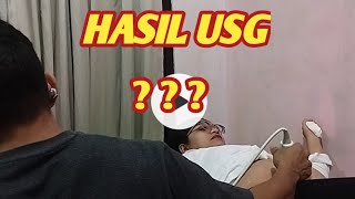 HASIL USG ADALAH [upl. by Ynafit754]