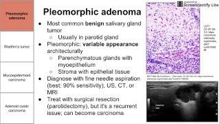 Salivary Gland Neoplasms [upl. by Arleen360]