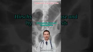 7 Surprising Causes of Megacolon You Need to Know [upl. by Ettenyl850]