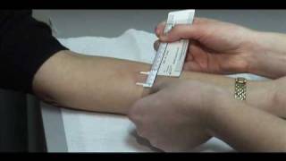 TB Skin Test  Mantoux Method [upl. by Nord396]