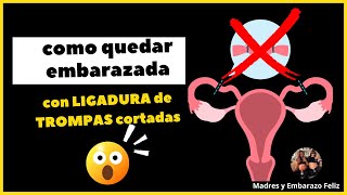 Como Quedar Embarazada con la Ligadura de Trompas embarazo [upl. by Euqinotna252]