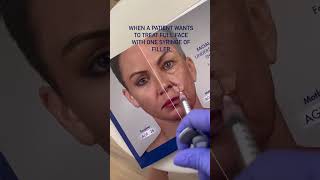 Expert Insights Balancing the Face with Filler [upl. by Kendrick]