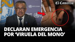 VIRUELA DEL MONO OMS declara EMERGENCIA de SALUD PÚBLICA INTERNACIONAL  El Comercio [upl. by Yelmene322]