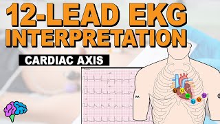 Understanding Cardiac Axis and Deviations  12Lead EKG [upl. by Aida]