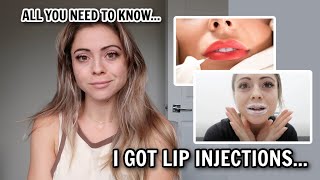 LIP INJECTIONS Before during and after the process Is it WORTH it [upl. by Antony421]