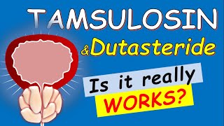 Tamsulosin and dutasteride  Is it WORKS for You  5 Things to KNOW [upl. by Balf]