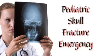 Skull Fracture Emergency in a 4YearOld Boy [upl. by Uyerta13]