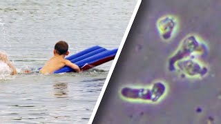 BrainEating Amoeba Found in Midwestern Lakes [upl. by Sonia988]