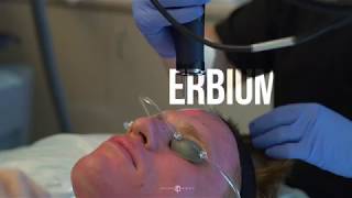 Erbium Fractional Laser  Live with Dr Jason Emer [upl. by Jochebed]