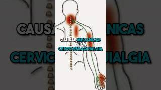 🛑 CAUSAS MECÁNICAS DE LA CERVICOBRAQUIALGIA ☝🏻 fisioterapiatualcance [upl. by Roer]