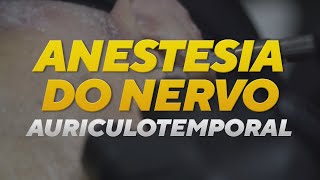 Como realizar a anestesia do nervo auriculotemporal Passo a passo [upl. by Vil]