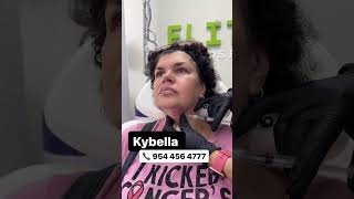 Kybella or deoxycholic acid by Dr Hegedosh in Boca Raton Florida [upl. by Ahsiya]