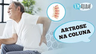 ARTROSE NA COLUNA O QUE Ã‰ SINTOMAS DIAGNÃ“STICO E TRATAMENTO [upl. by Joel678]