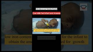 Why does quotCow Milkquot cause Anemia in a Newborn Baby [upl. by Akitan]