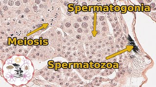 Insect Grasshopper Testes  Histology and Anatomy [upl. by Noah]