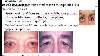 Ptosis lectureComprehensive Ophthalmology lecture A K Khurana [upl. by Nairolf]