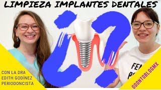 LIMPIEZA DE IMPLANTES DENTALES 🦷 con Dra Edith Godínez Padilla [upl. by Ydiarf]