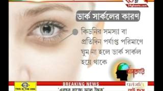 Tips to get rid of Dark Circles [upl. by Ettegirb212]