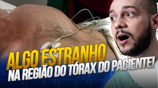 Pneumotórax Hipertensivo analisando um caso com o Dr Thiago [upl. by Almira]