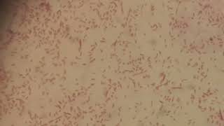 Gram Negative Bacteria Aeromonas hydrophila in Gram Staining [upl. by Lokim]