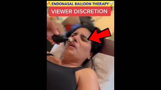 🔥Endonasal Balloon Therapy🤯shorts viral [upl. by Anrat]