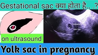 Gestational sac GShow to read pregnancy report yolk sac doctor home [upl. by Ermin19]