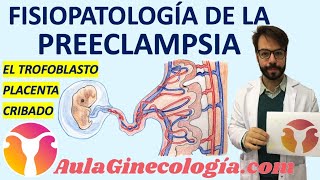 FISIOPATOLOGÍA DE LA PREECLAMPSIA DESARROLLO de la PLACENTA ANORMAL Ginecología y Obstetricia [upl. by Dehnel]