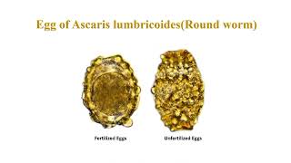 Ascaris lumbricoides egg morphology characteristics and identification [upl. by Oly]