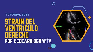 ✅STRAIN DEL VENTRÍCULO DERECHO por ecocardiografía 🥈Tutorial 2024 [upl. by Mingche]