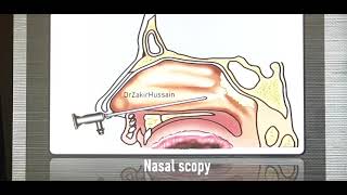 Acute nasopharyngitis Malayalam Patient teaching programme [upl. by Pike]