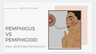 PEMPHIGUS VS PEMPHIGOID [upl. by Esirahc]