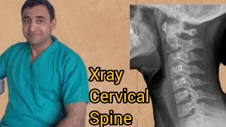 cervical spine x ray  cervical spine anatomy  how to interpret x ray neck  normal part 1 [upl. by Alfy999]