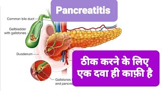 37 Pancreatitis Acute or Chronic not easy to treat why  Dr Manish Gupta होम्योपैथ [upl. by Gibby224]