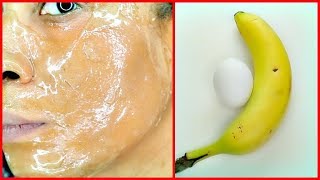 APPLY BANANA AND EGG ON YOUR SKIN ANTI  AGING REDUCE WRINKLES SPOTLESS FIRM SKIN Khichi Beauty [upl. by Grounds]