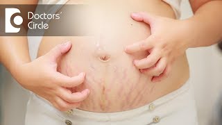 How to manage pregnancy rashes  Dr Tina Ramachander [upl. by Anowahs669]