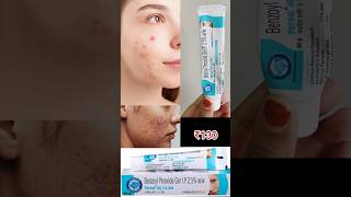 Benzoyl Peroxide Clindamycin Phosphate Gel Uses Benefits How to use  Cureskin Acne Duo [upl. by Ahsilrac]