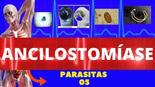 ANCILOSTOMÍASE AMARELÃO  ANCYLOSTOMA DUODENALE  NECATOR AMERICANUS  PARASITOLOGIA [upl. by Parthenia]