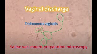 Trophozoites of Trichomonas in saline wet mount [upl. by Dinesh]