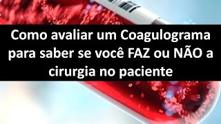 Como avaliar um coagulograma para saber se você faz ou não a cirurgia no paciente  Odontologia [upl. by Dorrie446]