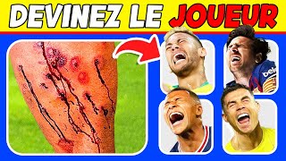 Devinez la blessure de la star du football 2 😭 Pouvezvous identifier ces moments Ronaldo Mbappe [upl. by Beaulieu]